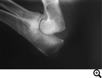 肘関節形成不全症/ FCP(内側鈎状突起分離症)