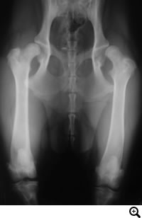 股関節形成不全症