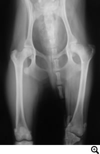 レッグペルテス/大腿骨頭無菌性壊死症