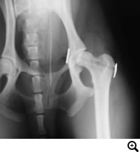 股間説疾患の治療法