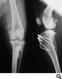 膝蓋骨脱臼グレード２〜３