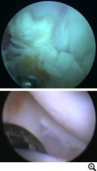 前十字靭帯断裂（中型犬、大型犬、超大型犬）