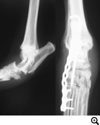 足根関節脱臼/不安定症