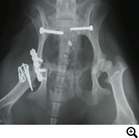 骨盤骨折、仙腸関節脱臼