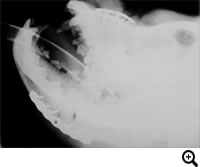 上顎骨・下顎骨骨折